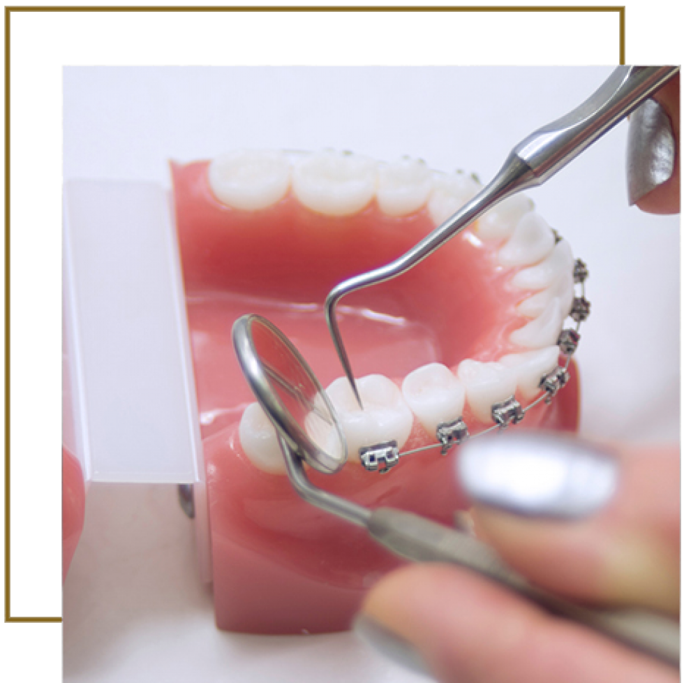 ORTODONTİ TEL TEDAVİSİ